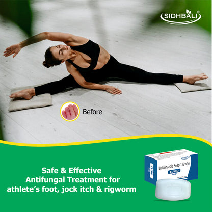 Lusid Luliconazole 1% Soap – 75g | Treats Fungal Infections, Athlete’s Foot, Dhobie Itch, Ringworm, Thrush & Dry, Flaky Skin | Pack of 1