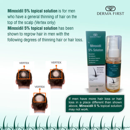 Derma First Minoxidil 5% Solution | Hair Regrowth Treatment for Men | Reactivates Hair Follicles | No Parabens & Sulphate | Promotes Thicker & Fuller Hair | 50ml I Pack of 1