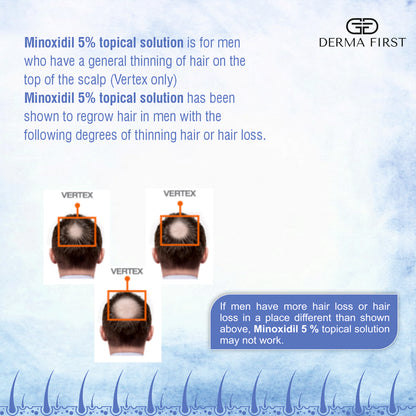 Derma First Minoxidil & Finasteride Topical Solution | Hair Regrowth Treatment For Men | Reactivates Hair Follicles & Boosts Hair Growth | Repairs Damaged Hair & Increases Hair Density | 50ml I Pack of 1