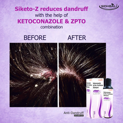 Siketo Z Anti-Dandruff Shampoo – Ketoconazole & Zinc Pyrithione | 100ml | For All Hair Types | Fights Dandruff, Itching & Scalp Flaking | Nourishes Scalp for Healthy, Shiny Hair