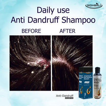 Anti-Dandruff Shampoo with Ciclopirox & Zinc Pyrithione | 100ml | Pack of 1 | Daily Use | Fights Dandruff, Itching & Flaking | Nourishes Scalp for Healthy, Shiny Hair