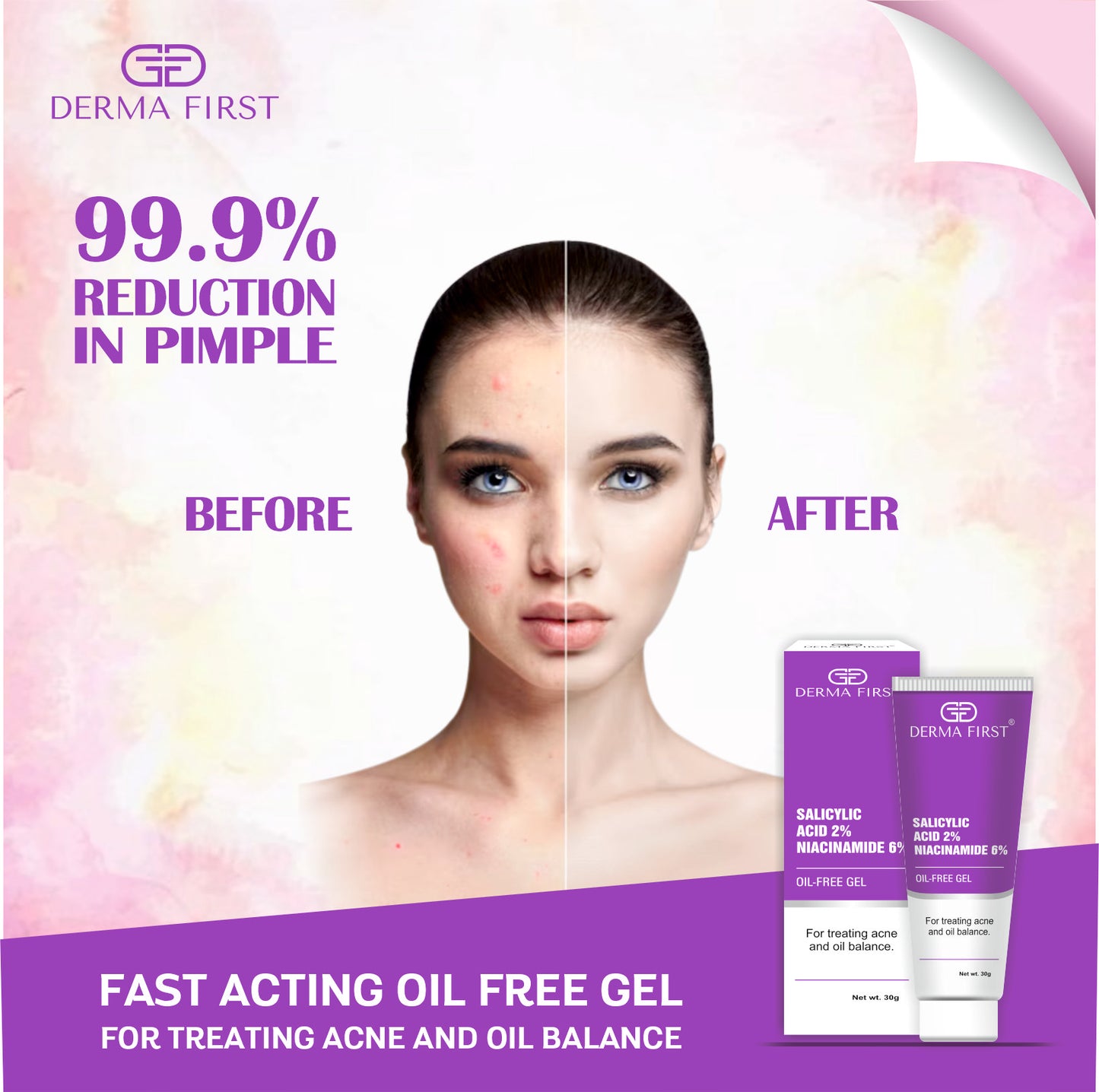 Derma First Anti-Acne Oil-Free Gel, Salicylic Acid 2%, Niacinamide 6%, For Active Acne, Oil Balance, Tightens Pores, 30G I Pack of 1